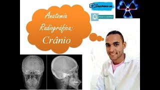 Anatomia Radiográfica do Crânio [upl. by Nniuqal]