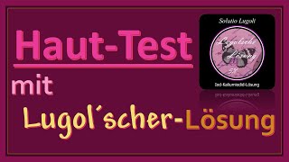 Hauttest mit Lugolscher Lösung [upl. by Alyhc]