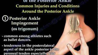 Ankle Pain Complete Overview  Everything You Need To Know  Dr Nabil Ebraheim [upl. by Hillari841]