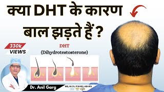 क्या DHT के कारण बाल झड़ते हैं  Do DHT Causes Hair Loss  Dr Anil Garg [upl. by Durrell]