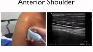 Introduction to musculoskeletal ultrasound [upl. by Prisilla]